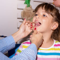 Oral Placement Therapy